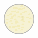 Cloudy or foamy urine | Urology Associates | Denver, CO